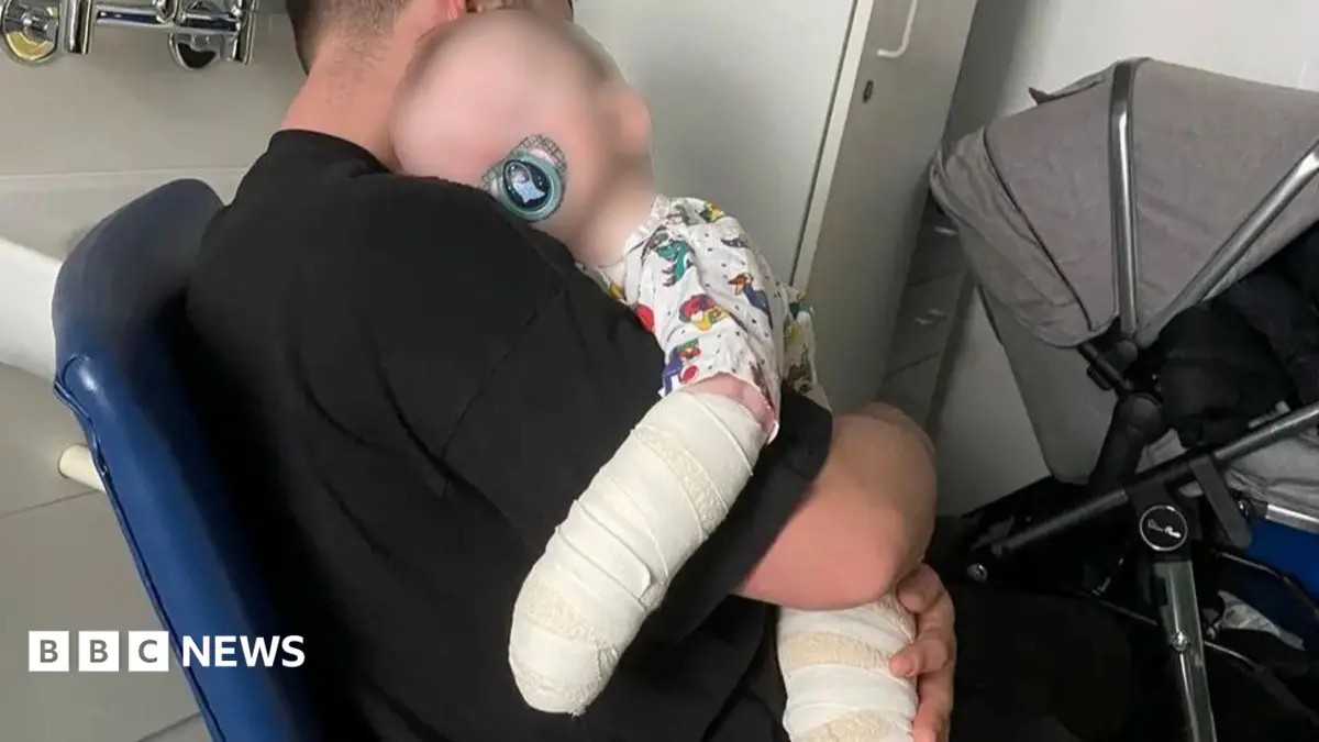 Aberdeen Nursery Fined £80,000 After Ten-Month-Old Boy Suffers Bleach Burns