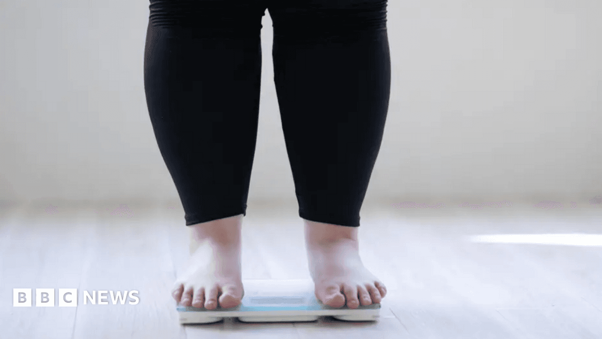 Obesity Cases Among Young Adults Increase Sharply in England, Driving NHS Pressures