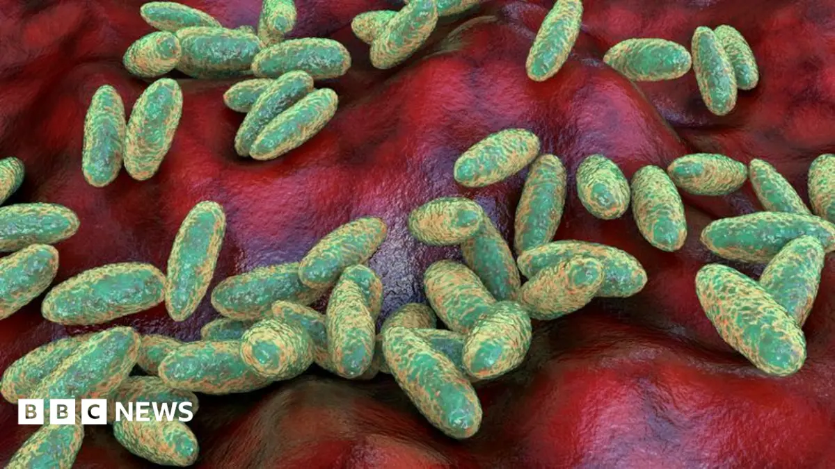 Russian Scientist Dies from Pneumonic Plague at Siberian Research Centre