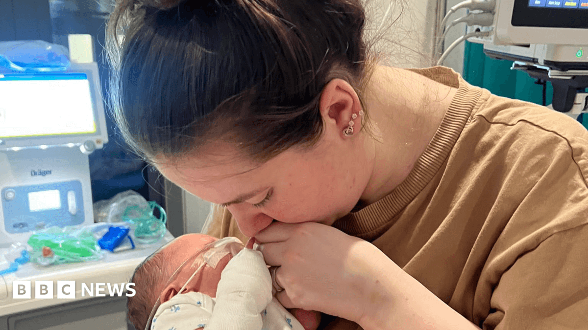 Critically Ill Baby's Mother Denied Hospital Meal as She Was Not Breastfeeding