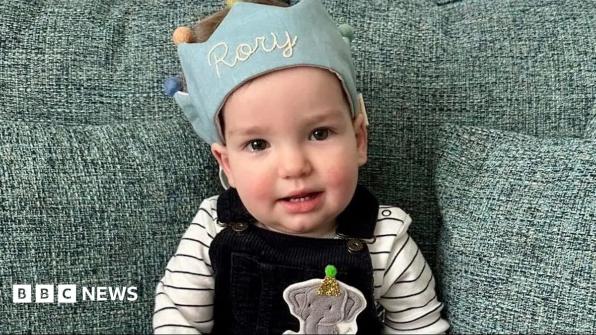 One-Year-Old Rory Undergoes UK-First Skull Reshaping Surgery Using Super-Elastic Springs