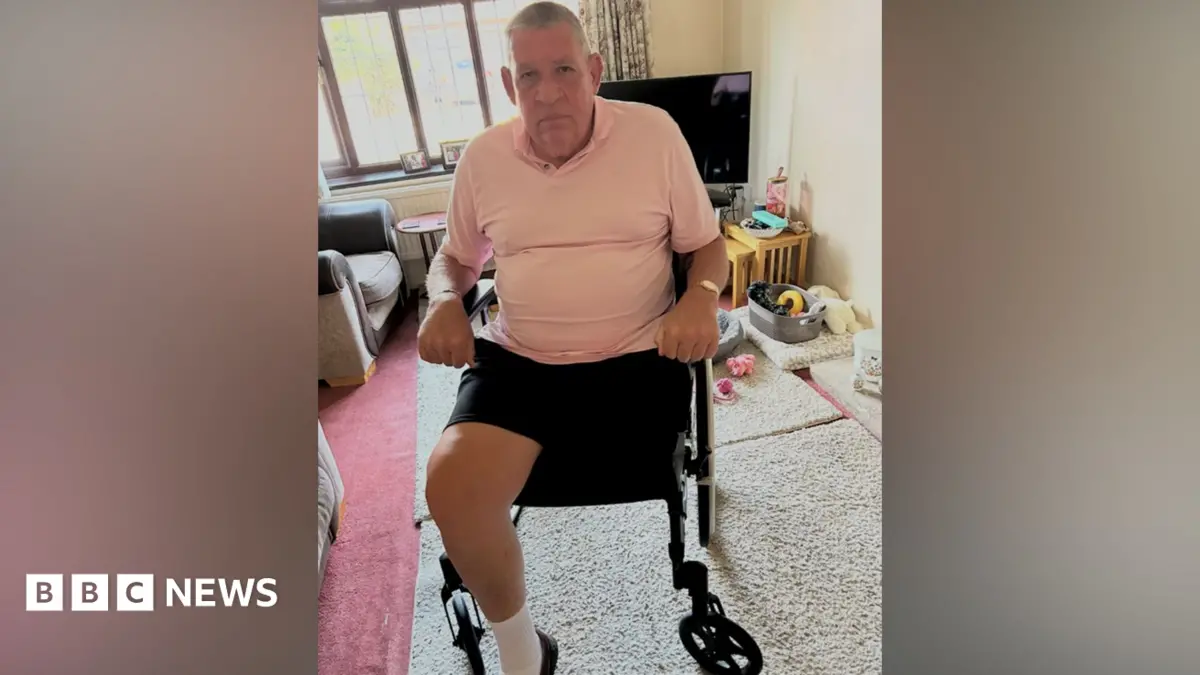 Amputee Nigel Ward Requires Additional Evidence for Blue Badge Renewal in Norfolk