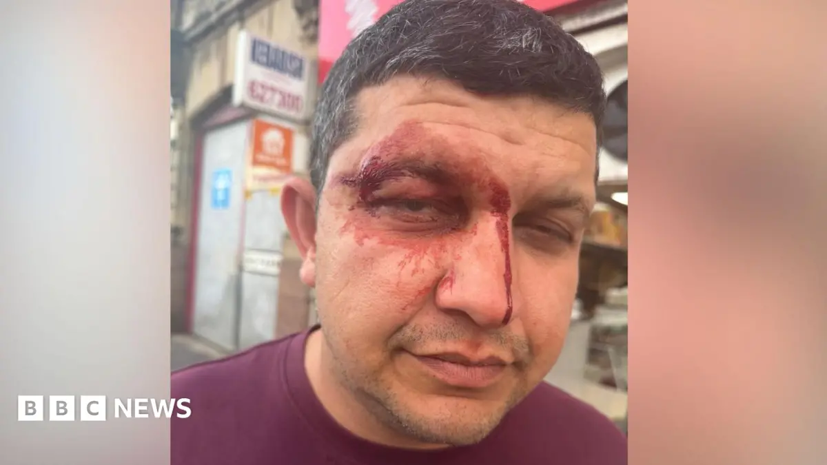 Falkirk Takeaway Owner Attacked, Racially Abused by Gang of Men