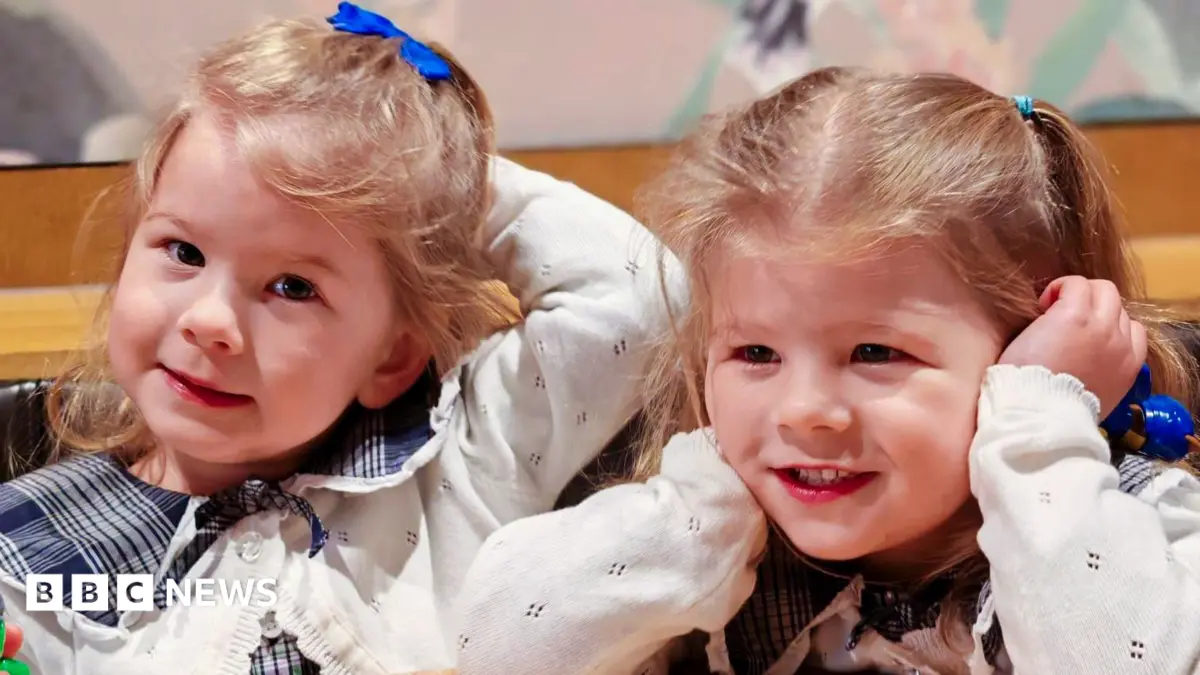 London Hospital Performs World-First Twin-to-Twin Transfusion Treatment on Identical Twins