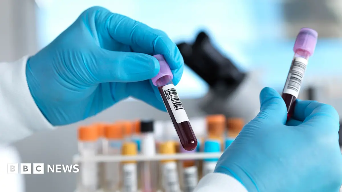 England Reports 90% Drop in Hepatitis C Cases, Nearing Elimination Target