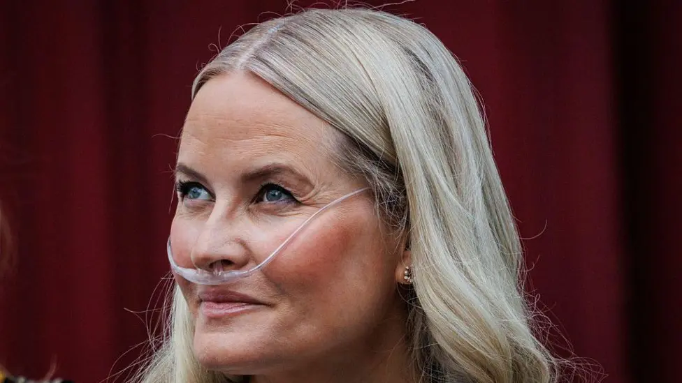 Norway's Crown Princess Mette-Marit Undergoes Successful Lung Transplant in Oslo Hospital