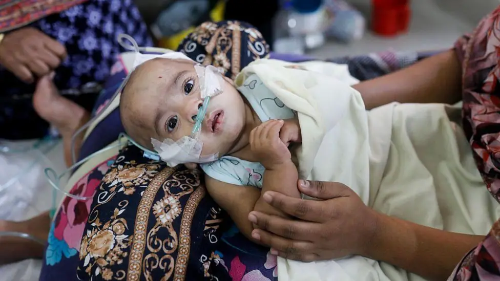Bangladesh Launches Emergency Measles Vaccination After Over 100 Deaths